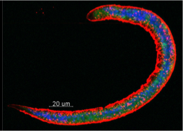 Interaction between allergen- and helminth-driven type-2 immune responses
