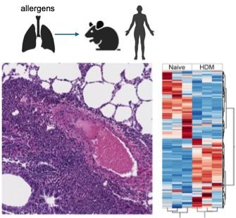 Molecular program of allergic diseases to identify therapeutical targets